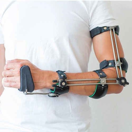 arm-orthosis-min (1)
