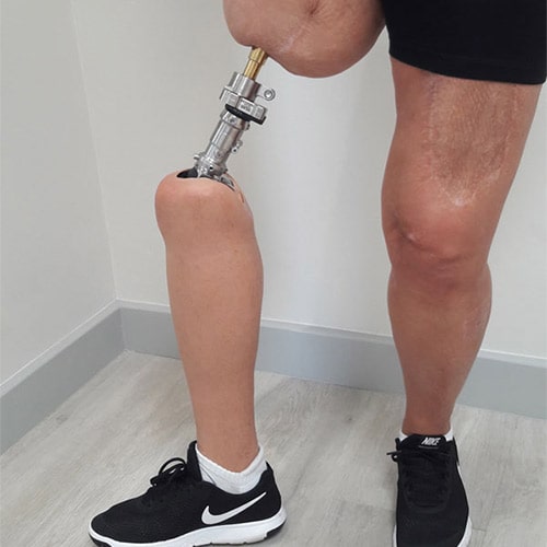thigh-prosthesis-min