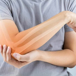 knee-darman-2 knee-darman-2