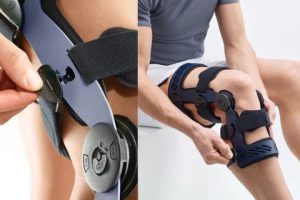 کاربرد ارتز زانو برای پارگی رباط صلیبی
