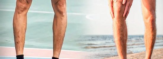 کفش طبی پای پرانتزی