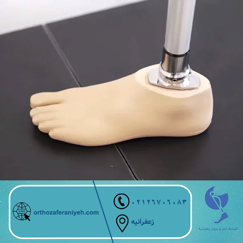 پروتز مچ پا کلینیک زعفرانیه