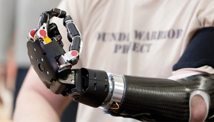 پروتز الکتریکی مچ دست
