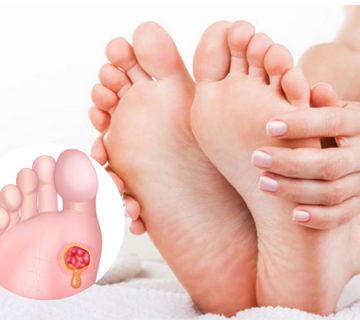 نقش اسکن کف پا در درمان زخم‌ های دیابتی