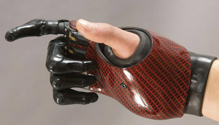 پروتز مایوالکتریک مچ دست