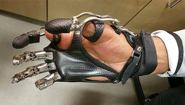 پروتز مکانیکی دست