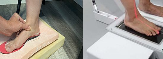 مقایسه اسکن کف پا با قالب گیری سنتی