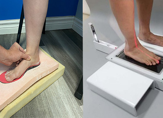 مقایسه اسکن کف پا با قالب گیری سنتی