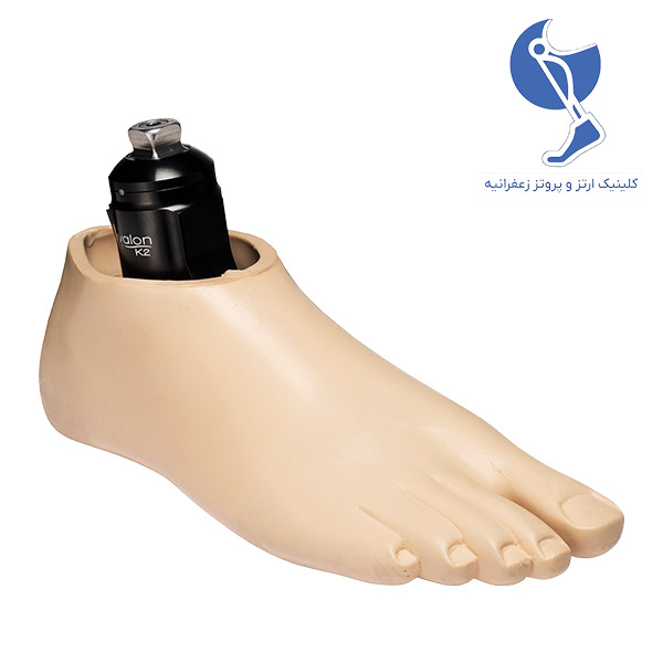 پروتز مچ پا ساده