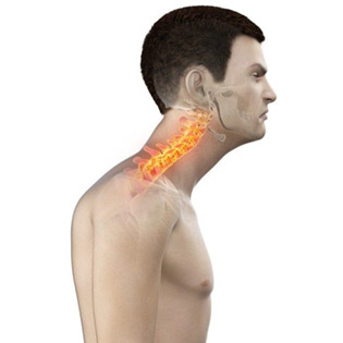 Forward-Head-Posture