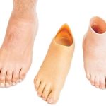 پای مصنوعی ژله ‌ای