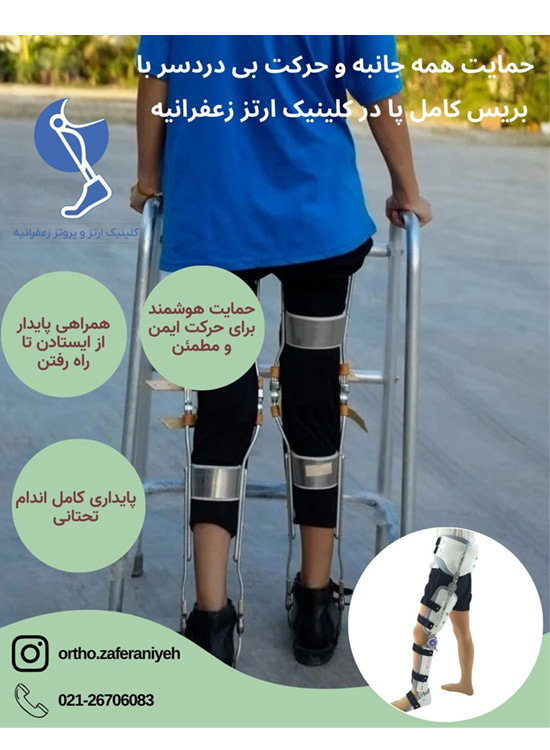 ساخت بریس کامل پا در زعفرانیه