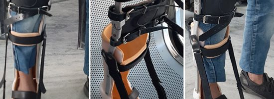 بریس فلج اطفال