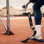 قیمت پای مصنوعی کربنی بالای زانو