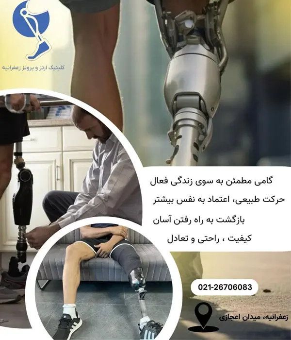پروتز پا زیر زانو