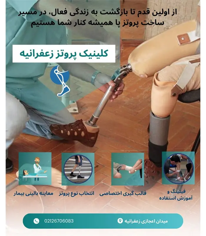 پروتز پا در تهران