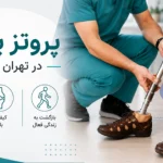 پروتز پا در تهران