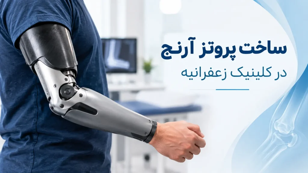 ساخت پروتز آرنج در کلینیک زعفرانیه