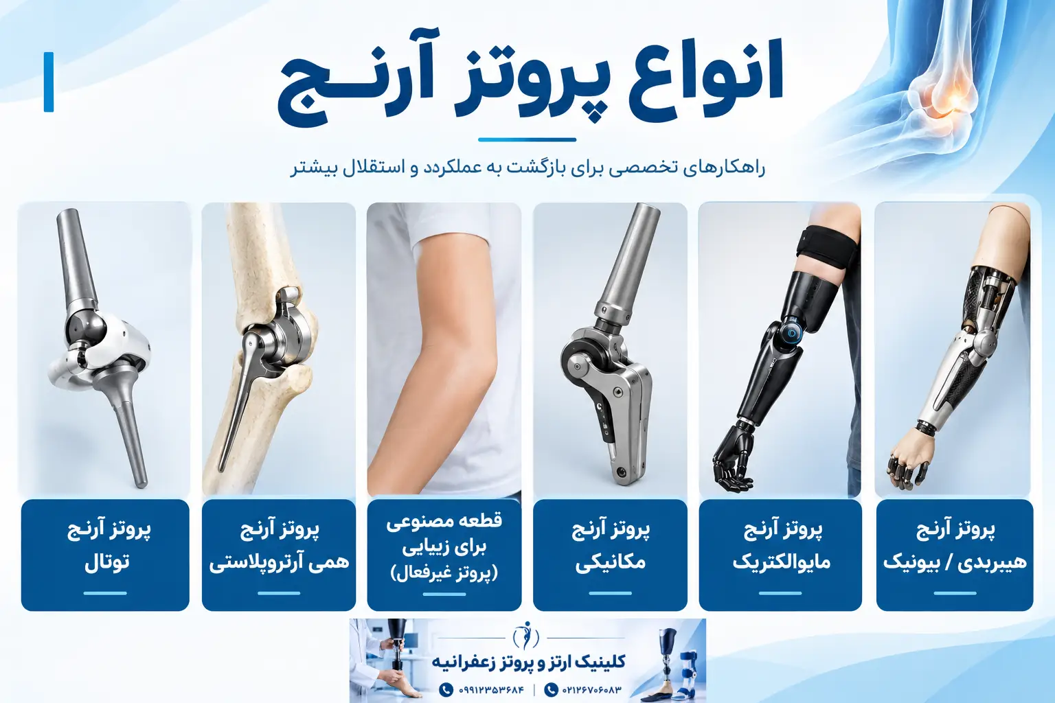 انواع پروتز آرنج