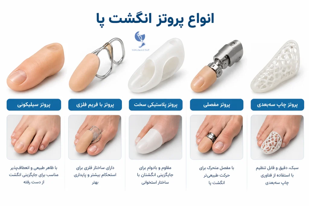 انواع پروتز انگشت پا