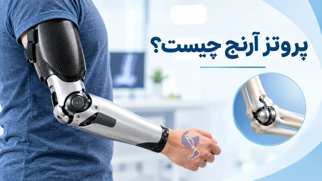 پروتز آرنج چیست؟