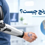 پروتز آرنج چیست؟