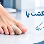 پروتز انگشت پا 150x150