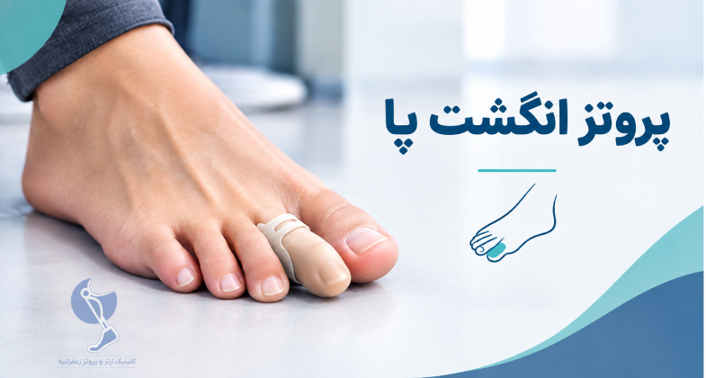پروتز انگشت پا