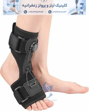ارتز افتادگی مچ پا