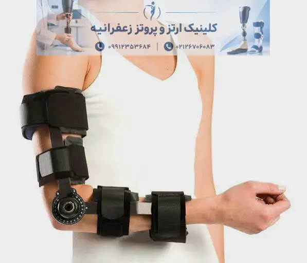 ارتز سفارشی فوقانی