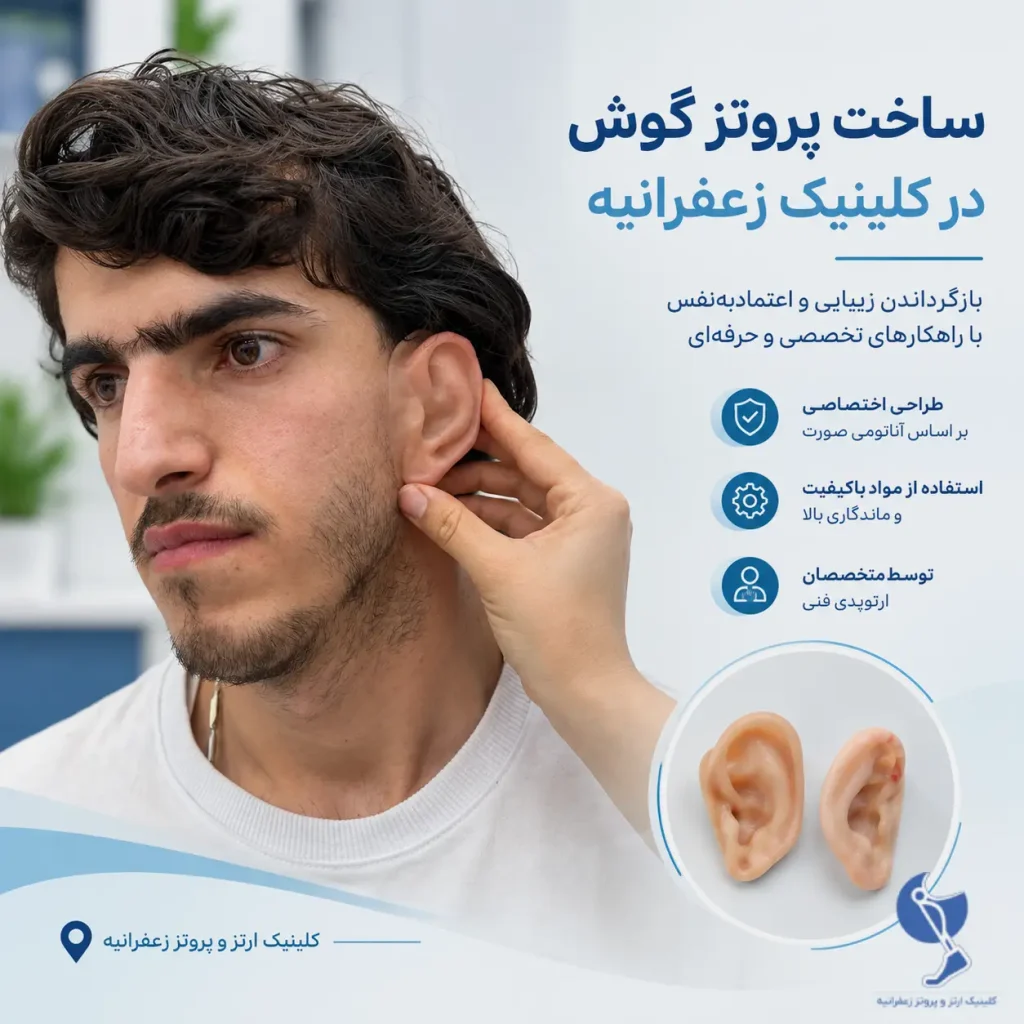 پروتز گوش در تهران