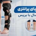 درمان پای پرانتزی در بزرگسالان با بریس