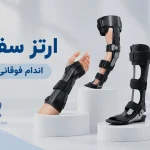 ارتز سفارشی