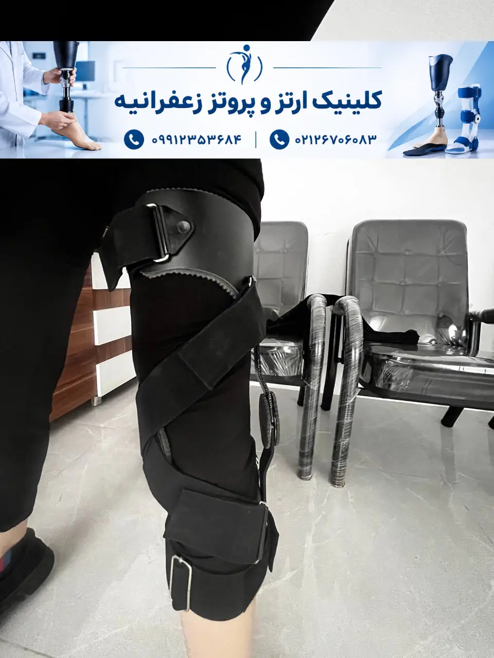 ساخت بریس زانو