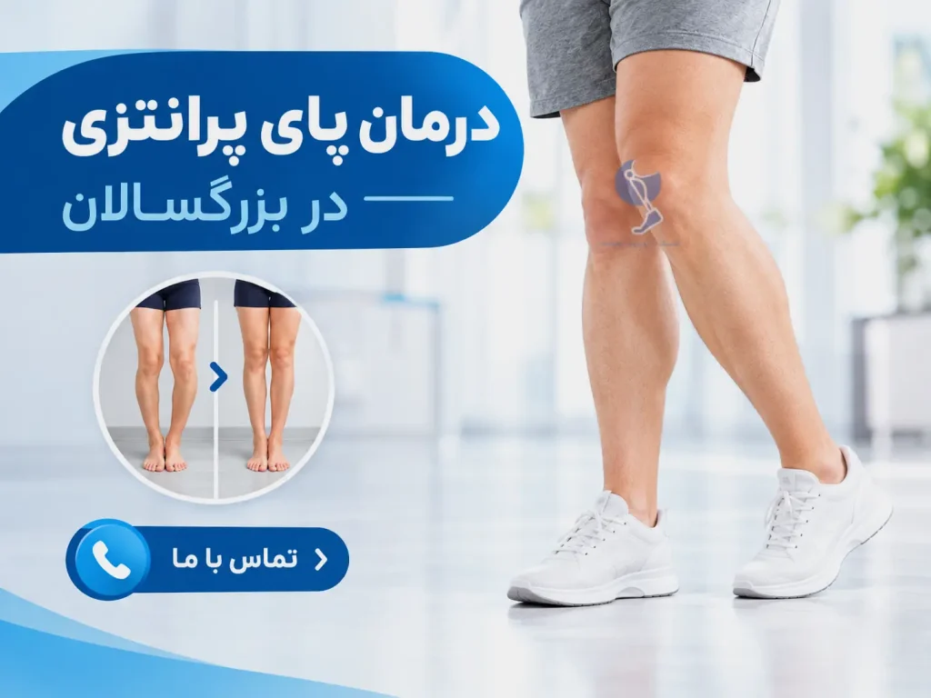 درمان پای پرانتزی در بزرگسالان با بریس