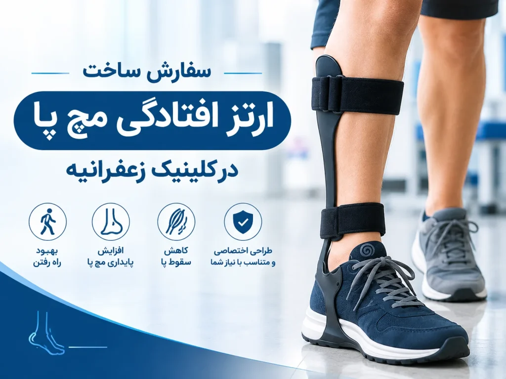 ارتز افتادگی مچ پا در تهران