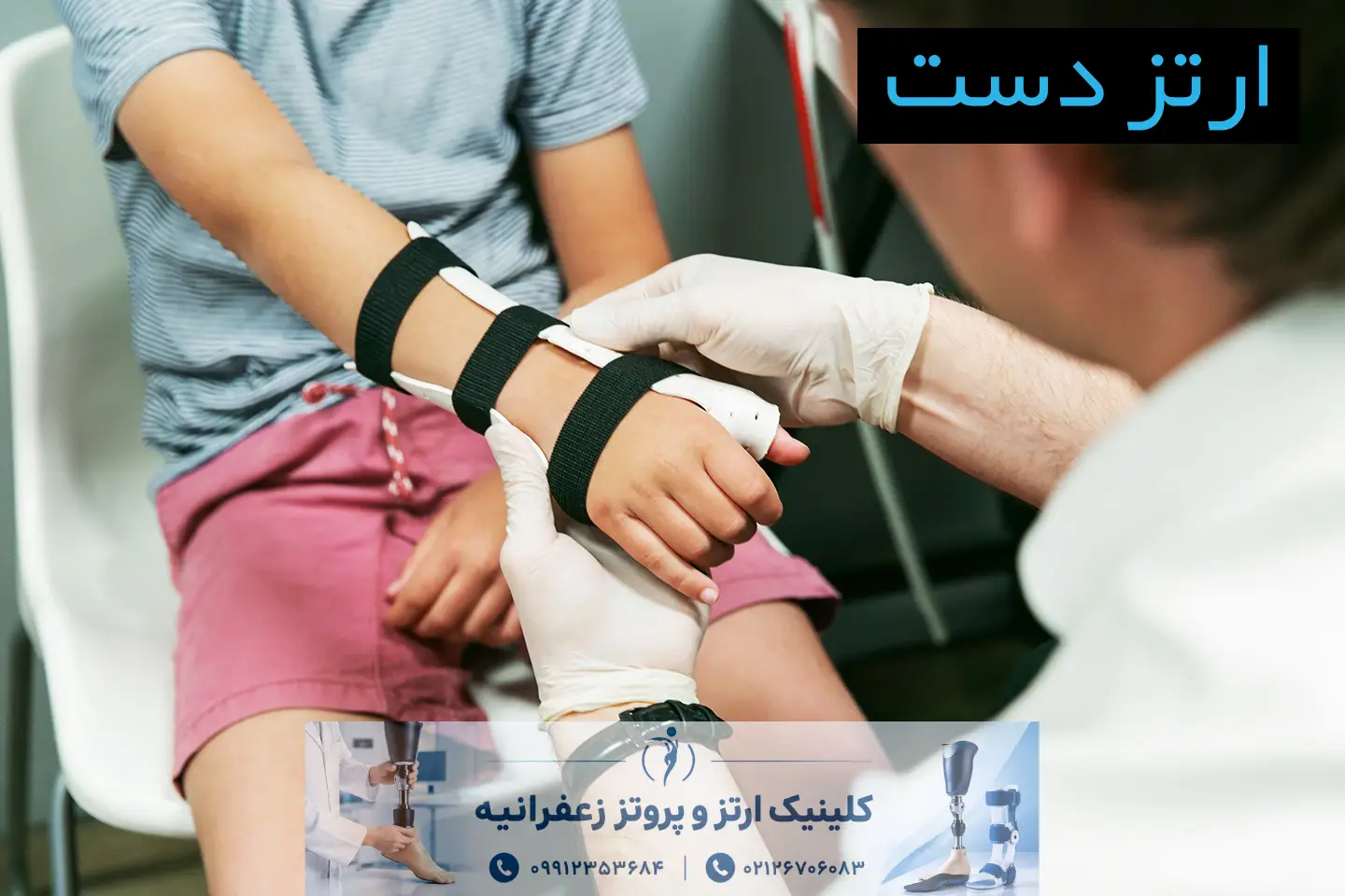 ارتز سفارشی