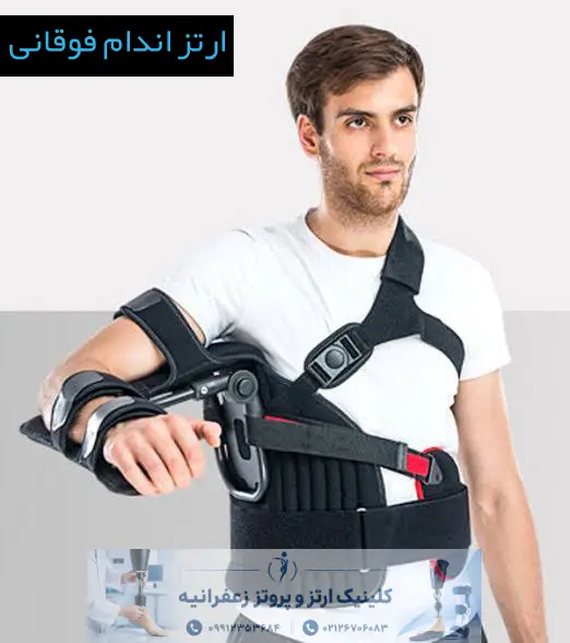 ارتز سفارشی اندام فوقانی