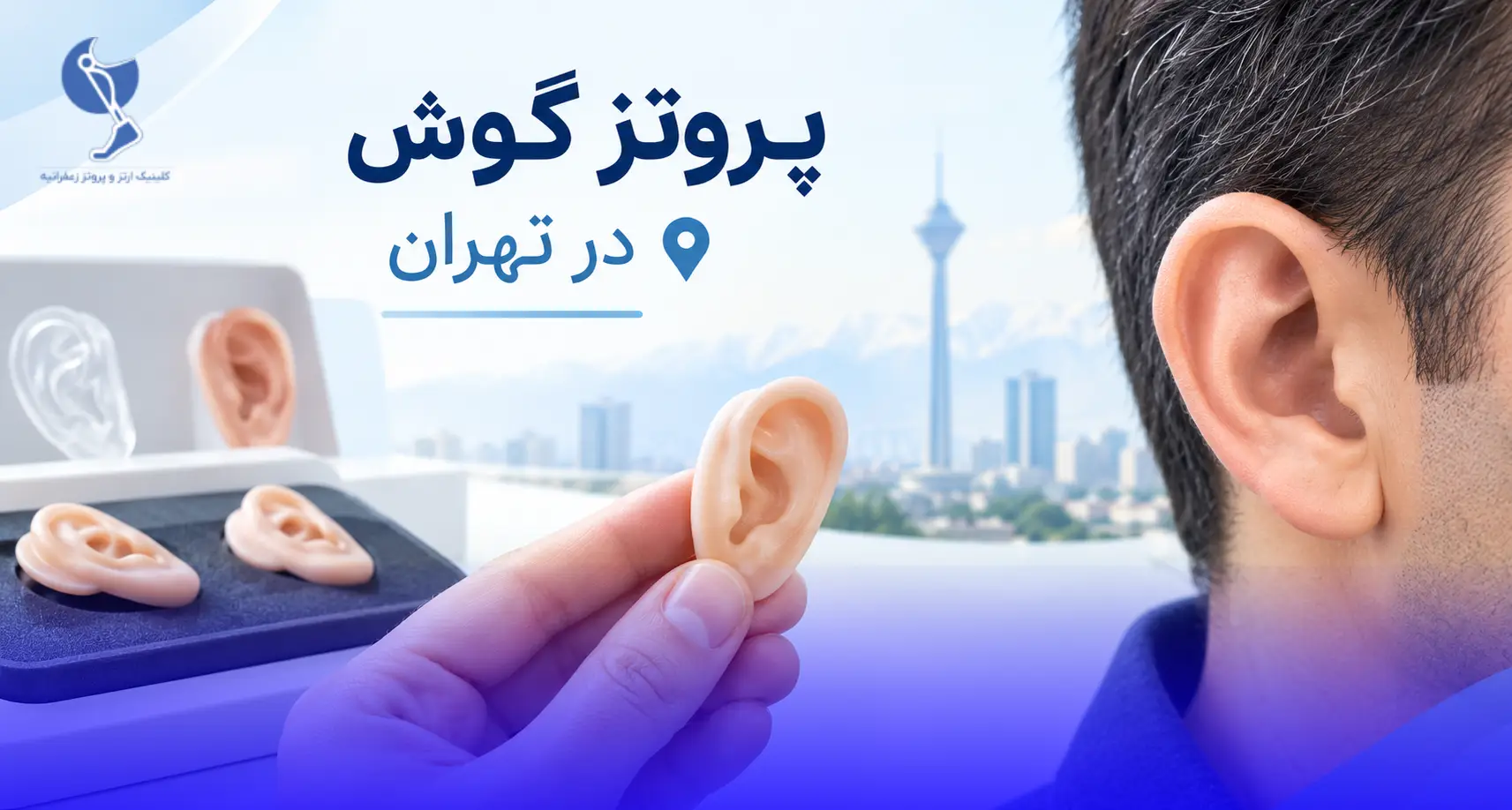 پروتز گوش در تهران